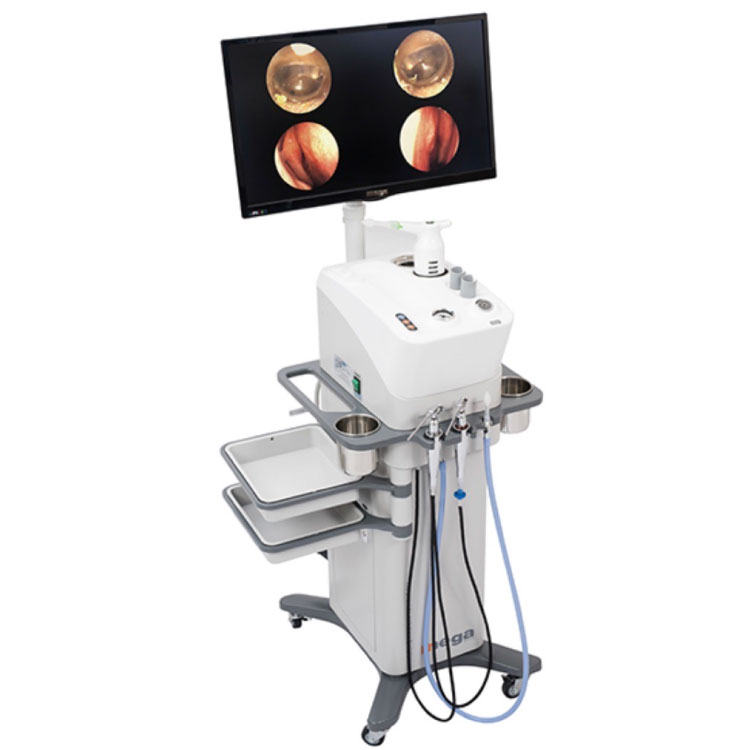 鼻の内視鏡で検診時のフォローも徹底