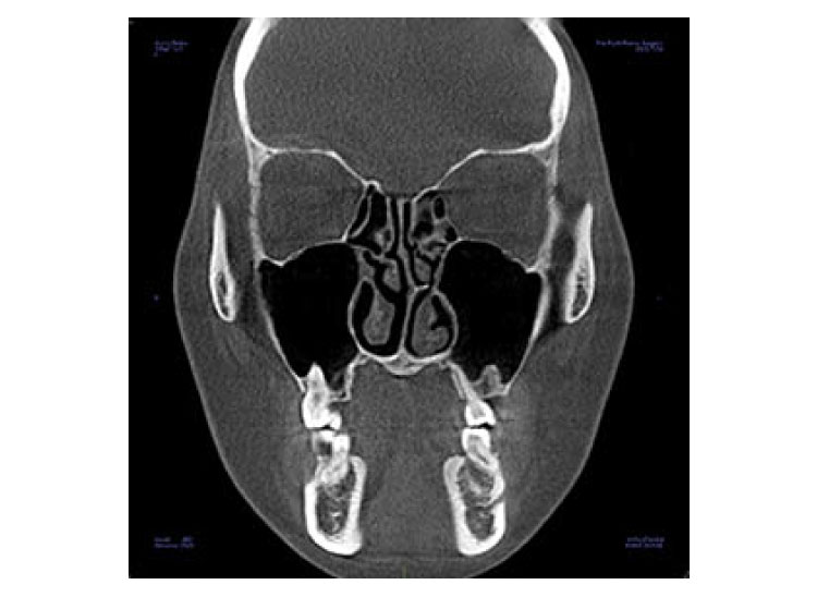 CTの撮影でこんなことが分かります