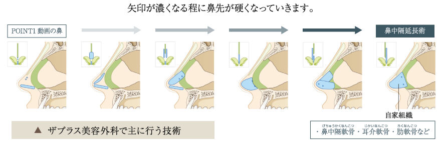 矢印が濃くなる程に鼻先が硬くなっていきます。