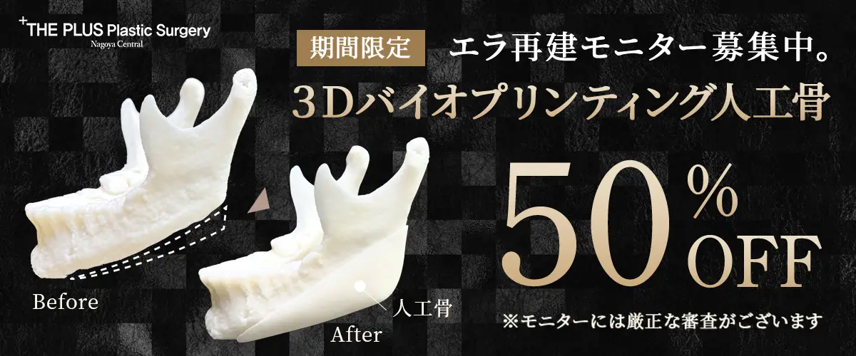 自家骨と置き換わる3Dバイオプリンティング人工骨 50%OFF モニター募集