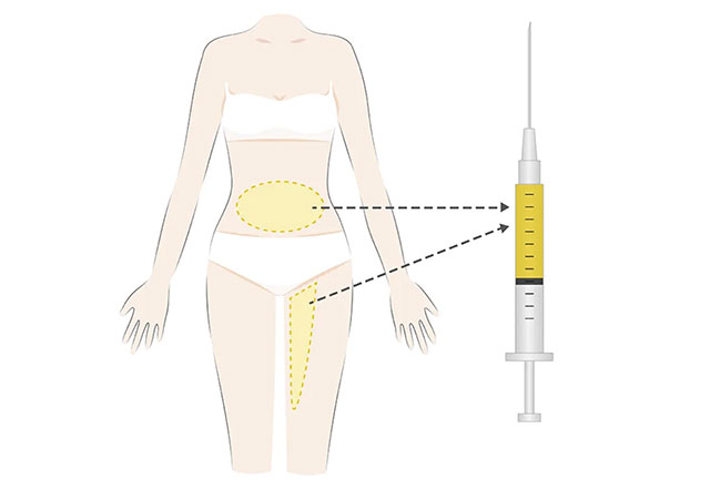 ハイブリッド豊胸
